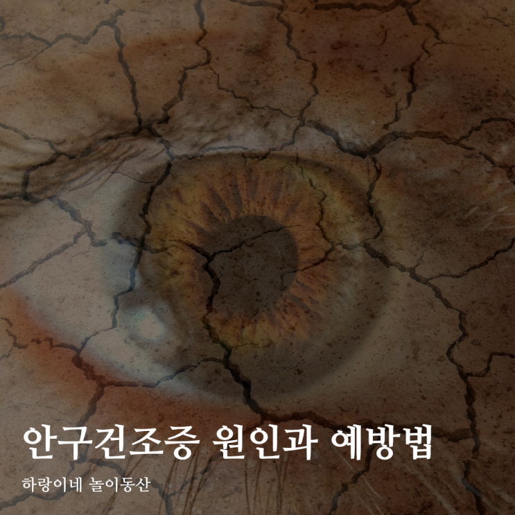  광주안과 옐르가 알려주는 안구건조증 원인 예방법