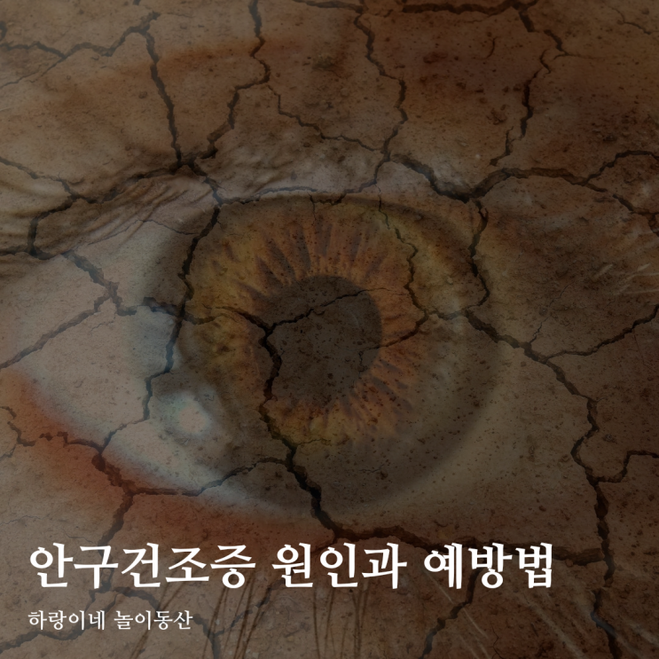 광주안과 옐르가 알려주는 안구건조증 원인 예방법