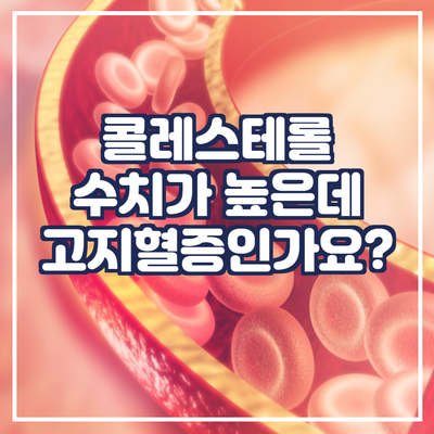 콜레스테롤 수치가 높은데 고지혈증인가요?