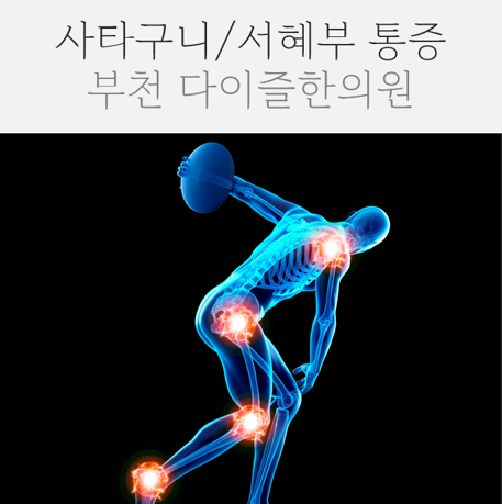  부천한의원 서혜부통증 사타구니통증 ::  속옷라인을 따라 아파요