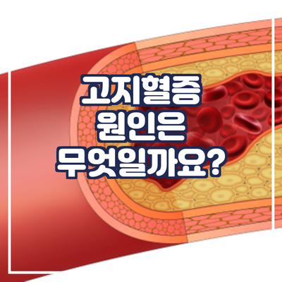  고지혈증의 원인이 있나요?