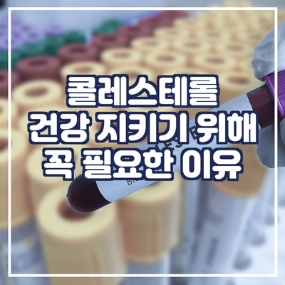  콜레스테롤 역할, 건강 지키는데 필수