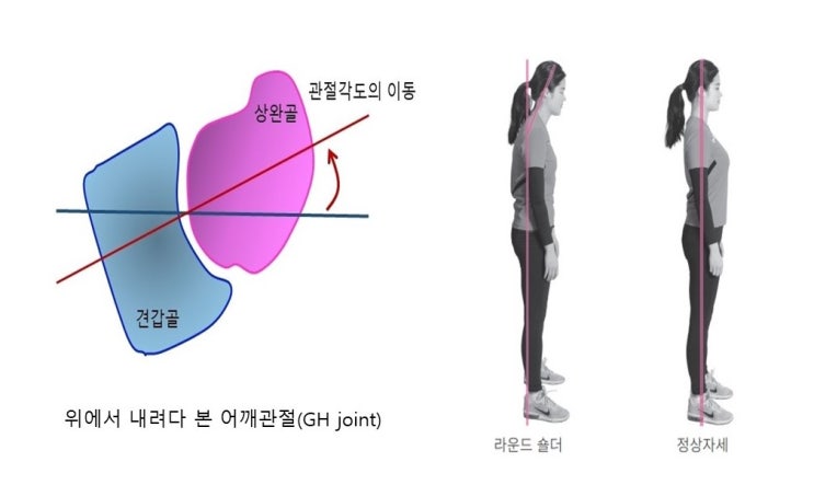  주동근과 대항근(길항근), 안정근의 균형발달