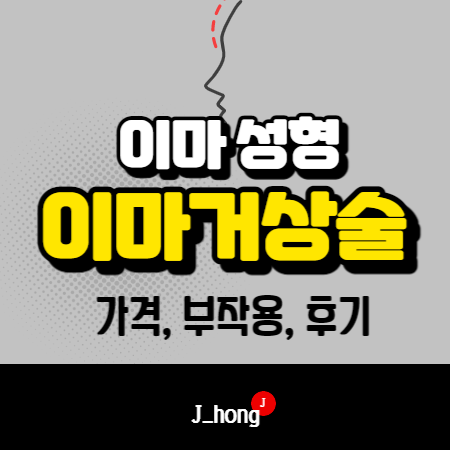 이마 성형, 이마거상술 정보 (가격, 부작용,후기)