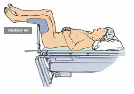  수술 중 체위, 자세(position)(2): lithotomy, trendelenberg, reverse trendelenber position까지