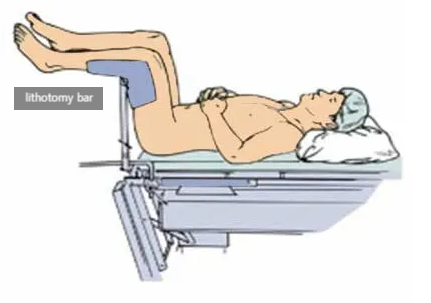 수술 중 체위, 자세(position)(2): lithotomy, trendelenberg, reverse trendelenber position까지