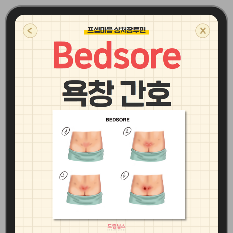 bedsore 욕창 단계부터 예방 간호까지 bedsore 욕창 단계부터 예방 간호까지