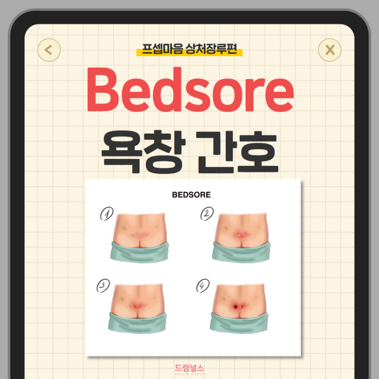 bedsore 욕창 단계부터 예방 간호까지