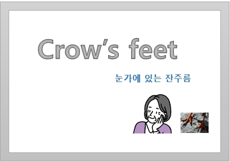 crow's feet 눈주름 영어 표현, 눈주름 예방법