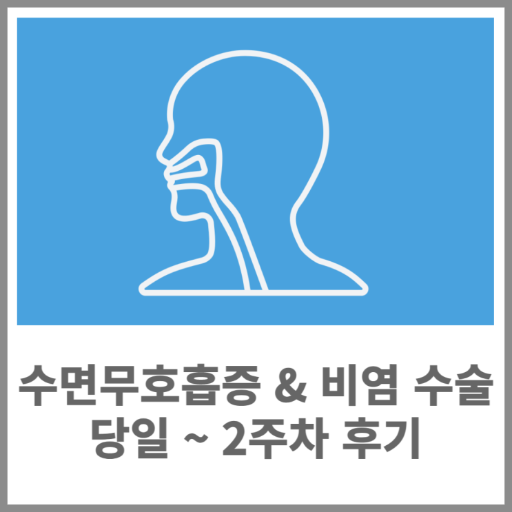  코골이 및 수면무호흡증 수술 & 편도절제술 & 하비갑개절제 후기(당일 ~ 14일)