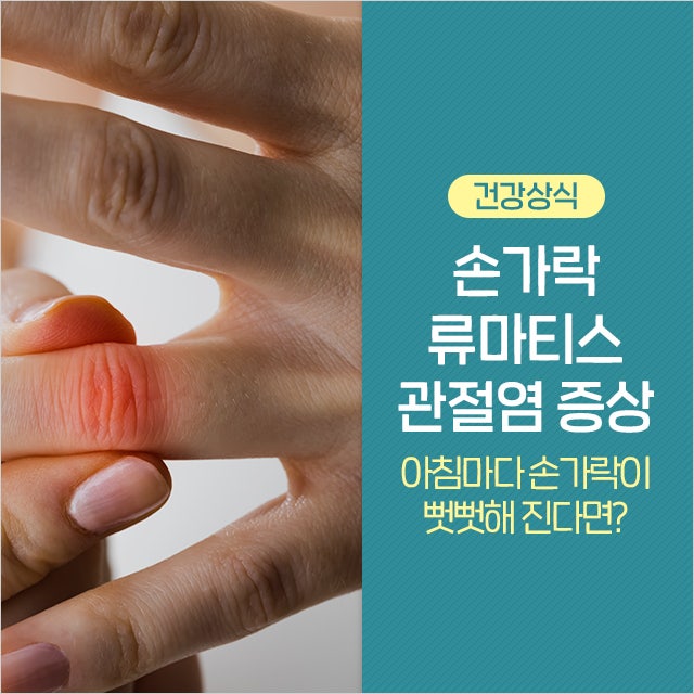 류마티스 관절염 손가락의 증상 및 검사 및 손가락 관절 뼈 통증의 원인 정보 6