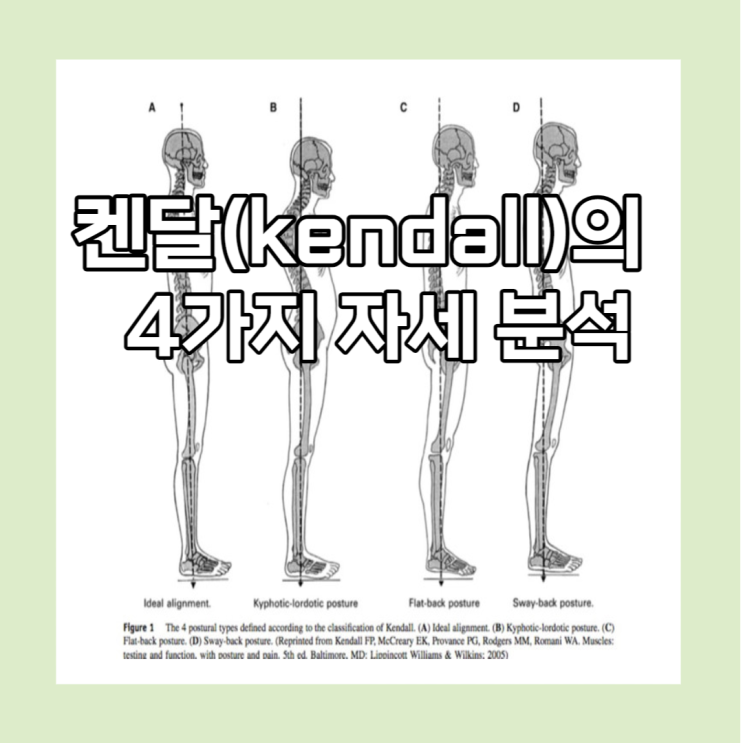 켄달(kendall)의 4가지 자세 분석