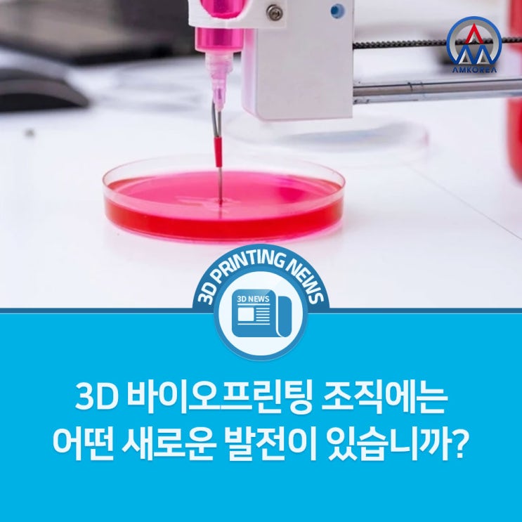  [3D 프린팅 뉴스] 3D 바이오프린팅 조직에는 어떤 새로운 발전이 있습니까?