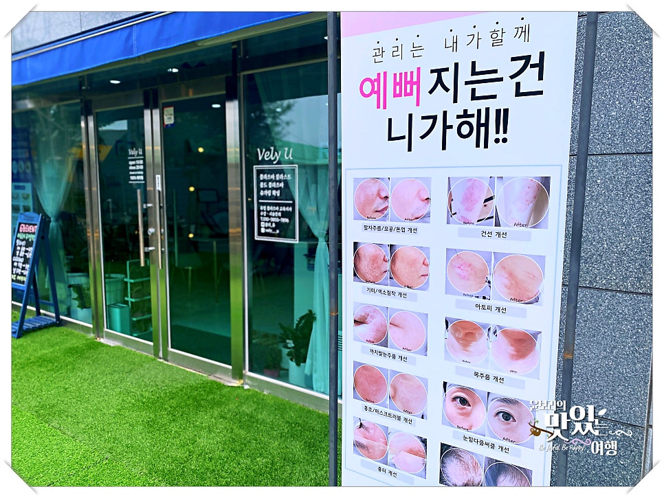 블리유 사진 4