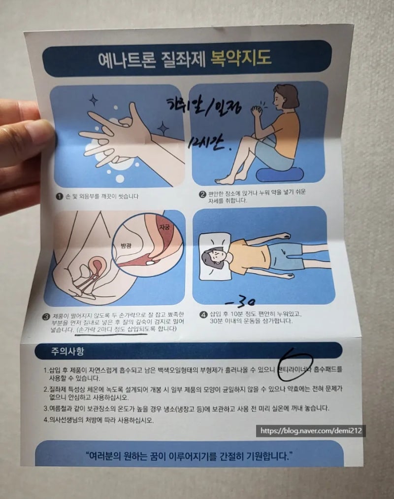 난임일기] 동결배아 이식준비 / 프로게스테론 성분예나트론 질정제 / 질정제주의사항 : 네이버 블로그