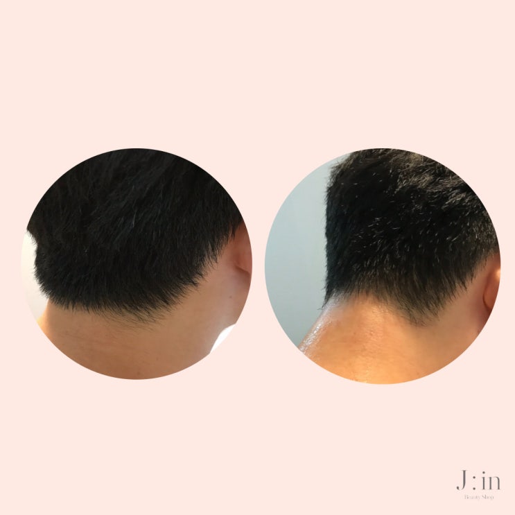  상동왁싱/부천왁싱/남자뒷목왁싱/제이인왁싱
