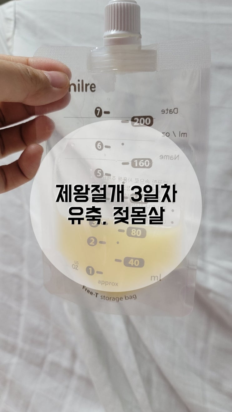  둘째 제왕절개 3일차 유축, 페인부스터제거, 무통제거,젖몸살,