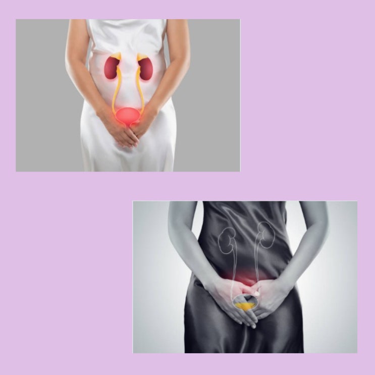  여성 방광염 증상과 원인, 치료방법 알아보기
