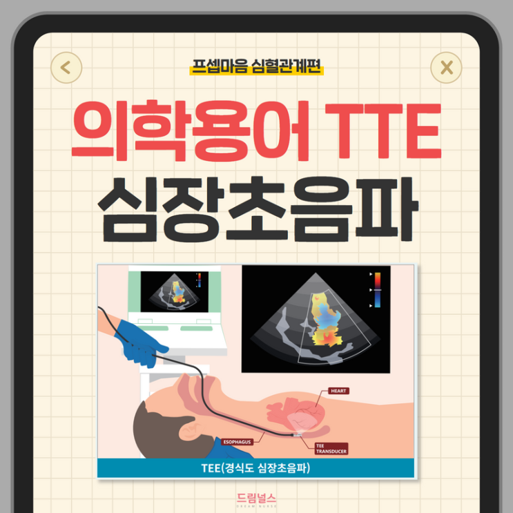 의학용어 TTE TEE 검사 방법, 차이점, 주의사항