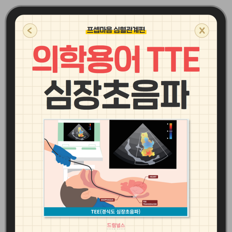의학용어 TTE TEE 검사 방법, 차이점, 주의사항 의학용어 TTE TEE 검사 방법, 차이점, 주의사항