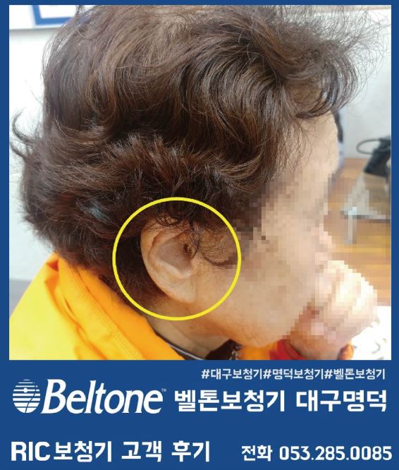  대구보청기 오픈형 보청기 착용 사례를 알려드립니다~!