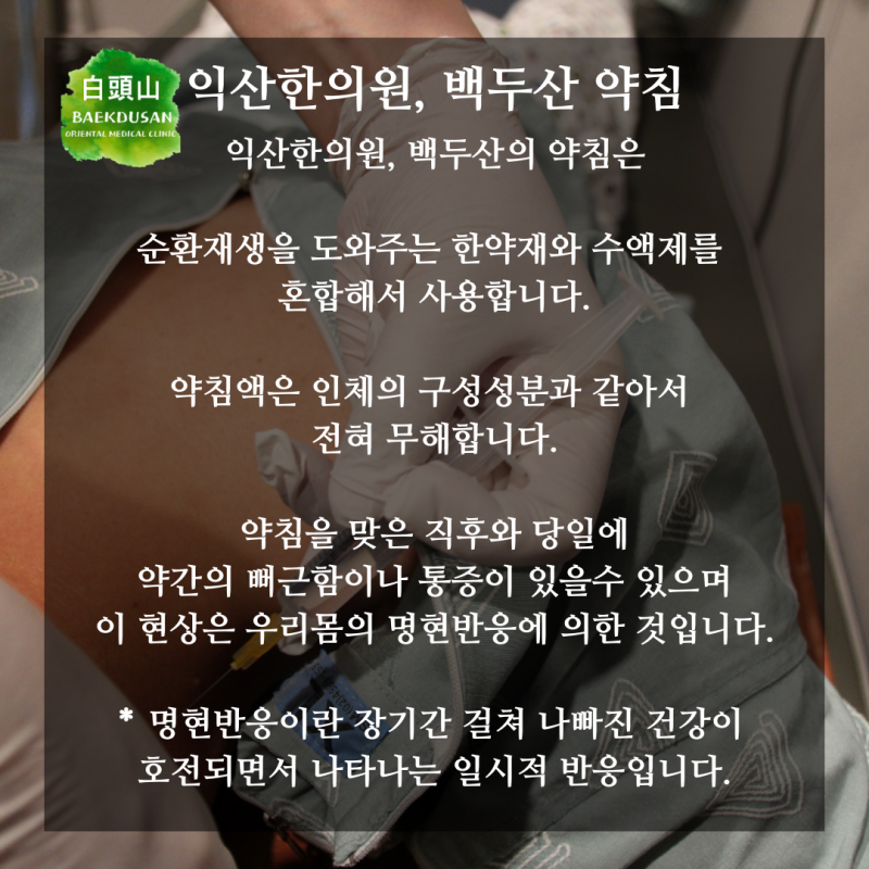 순환 재생에 도움을 주는 익산 한의원 침술