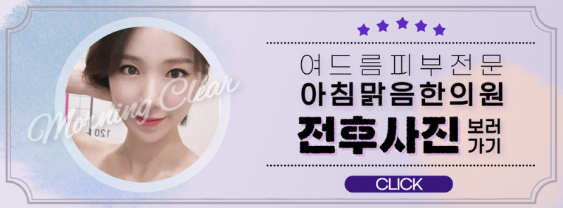 건대피부과 유명한 곳에서 검은 여드름을 잡아주세요. 5