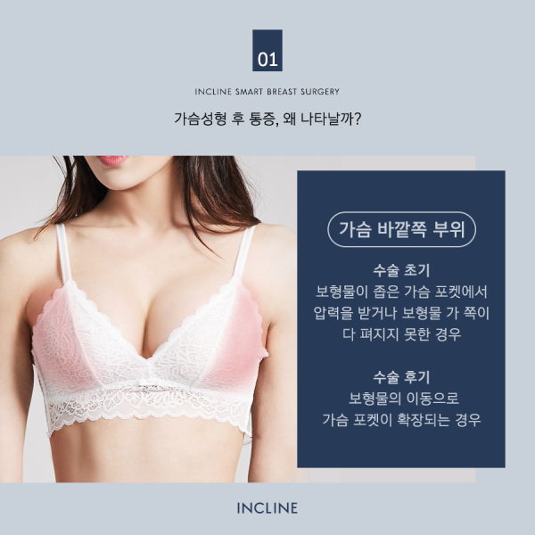 코셀성형외과 > 유방성형수술 후 수유시간 (가슴수술통증?) 8