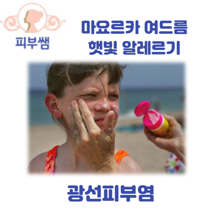  마요르카 여드름 햇빛 알레르기 광선 피부염