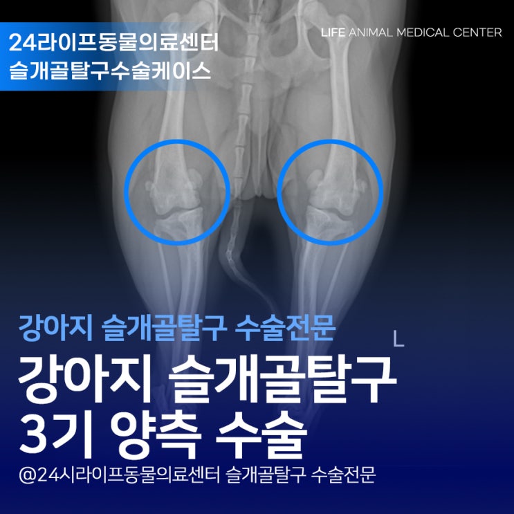 대구 강아지 슬개골탈구 3기 양측 수술 : 잘 걸어다니는데 슬개골탈구 3기일 수 있나요?