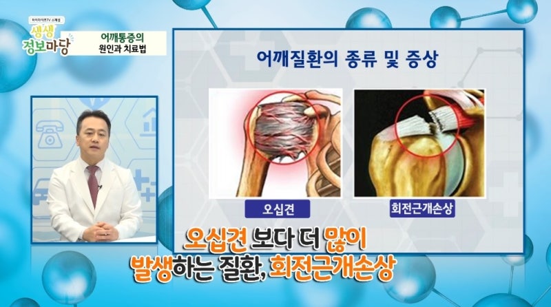 장위동짐)어깨회전근개파열시증상및치료