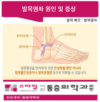  [발목이 아플때, 삐끗했을때] 발목염좌(통증)의 원인 및 증상파악!