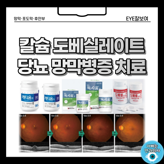  비증식성 당뇨병성 망막병증에서 칼슘 도베실레이트의 효과