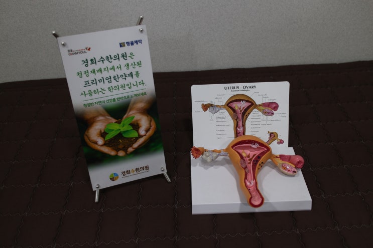  자궁내막증 원인, 증상, 한약 치료