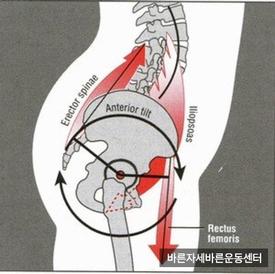  [신반포PT] 사무직을 위한 운동 세 번째! 허리 통증 완화 운동!(part.1 전방 경사)