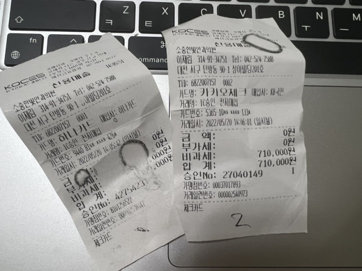  대전 소중한빛안과 라섹 후기
