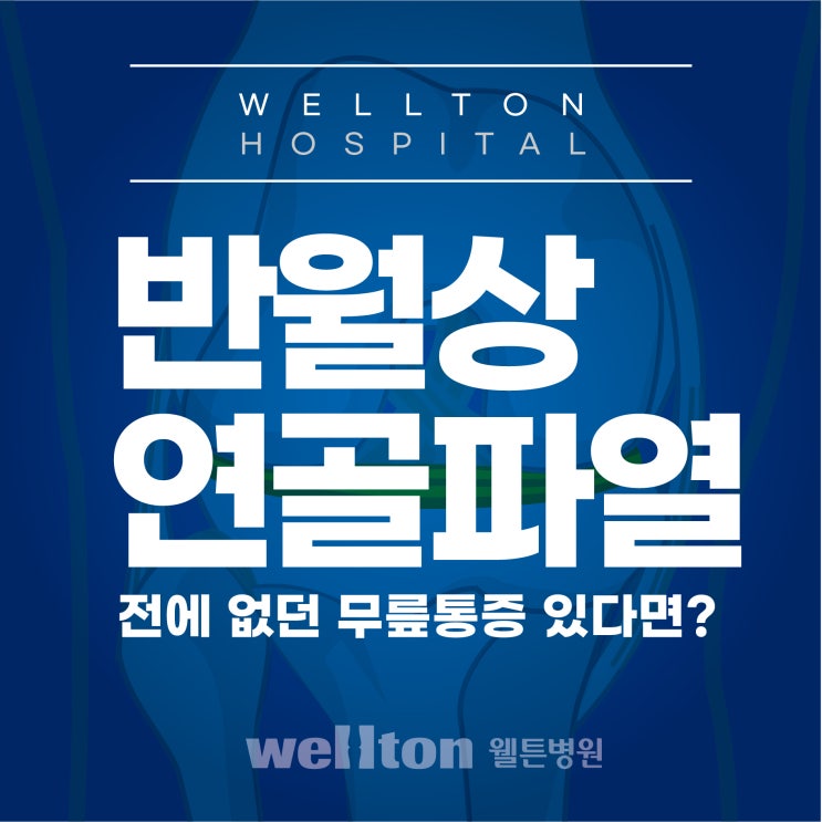  가양동정형외과, 갑자기 무릎이 아파요