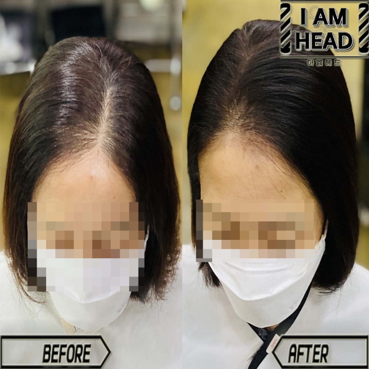  [주간일기 챌린지] 링거펌으로 가르마 바꾸기!