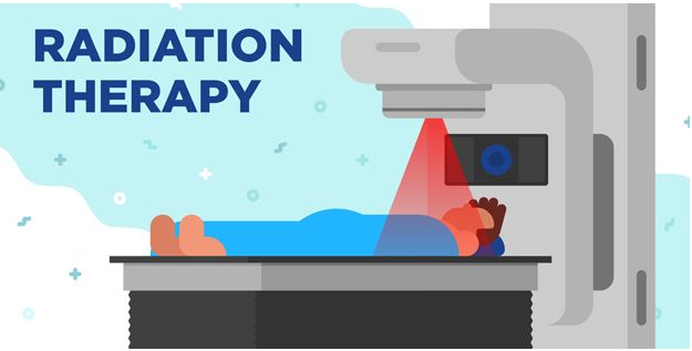 방사선 치료의 종류 (radiation therapy, RT)