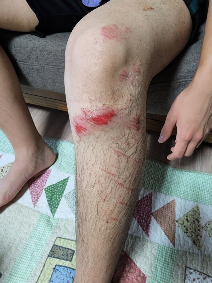 파란만장, 난리블루스, 이게 뭔 일이야... 파란만장, 난리블루스, 이게 뭔 일이야...