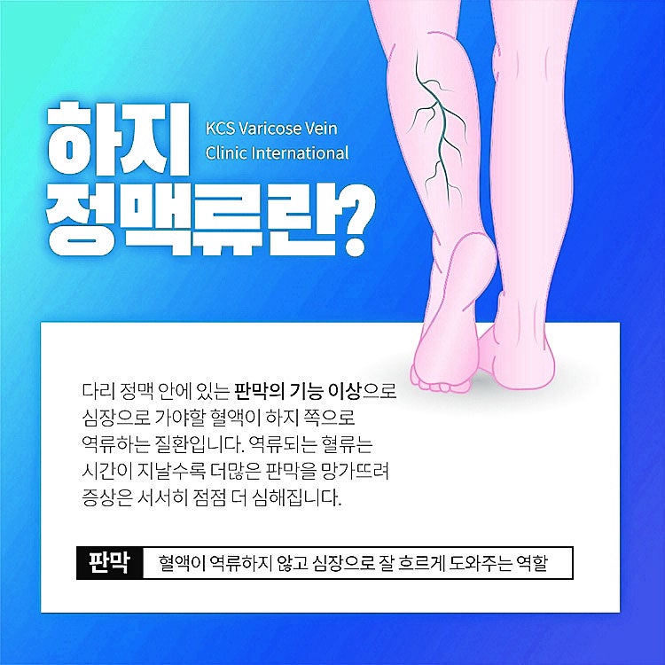 마산, 창원 하지정맥류 치료는 어디서? 당장 치료해야하나요?