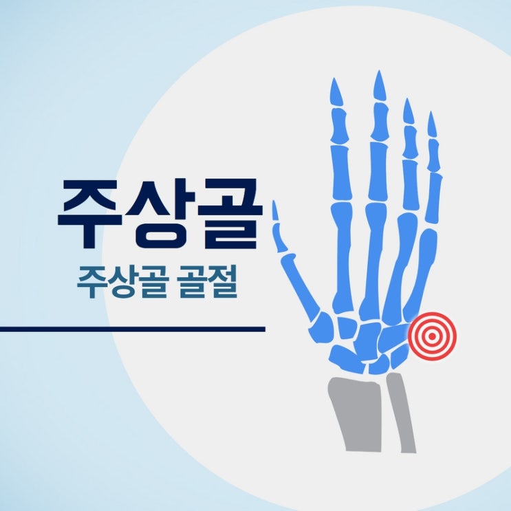  주상골 골절 통증 조심하세요!