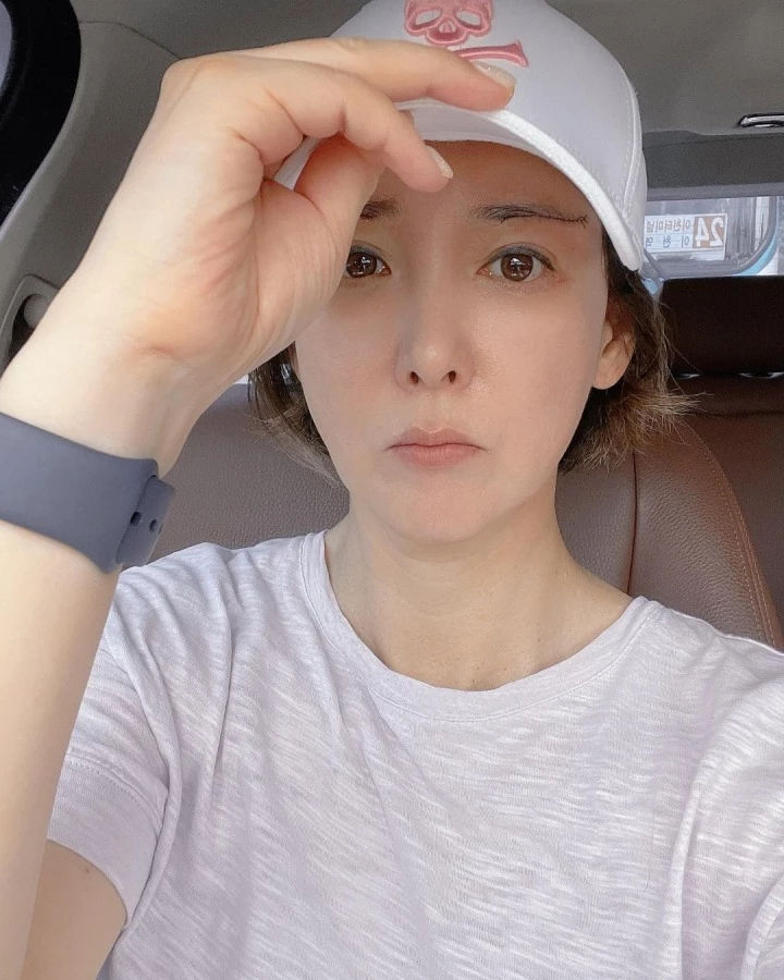 배우 이상아, 성형 후 "실밥 제거 날" 성형외과에서 눈썹 거상술 받았다고 고백해 화제 배우 이상아, 성형 후 "실밥 제거 날" 성형외과에서 눈썹 거상술 받았다고 고백해 화제
