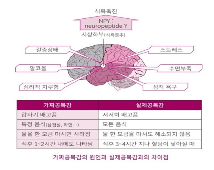  가짜 배고픔(공복감) 원인과 진짜 배고픔과의 구별법