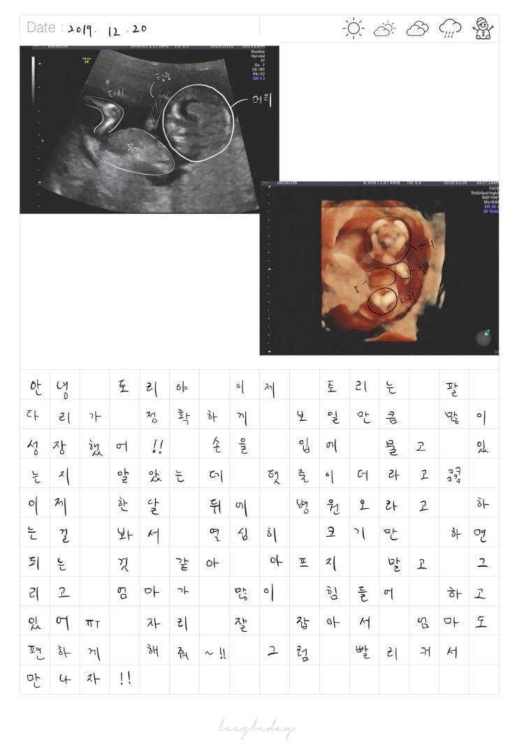  2019.12.20태아일기