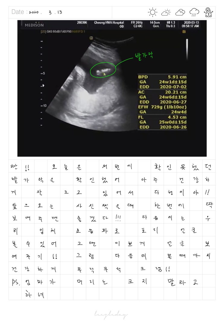  2020.03.13태아일기