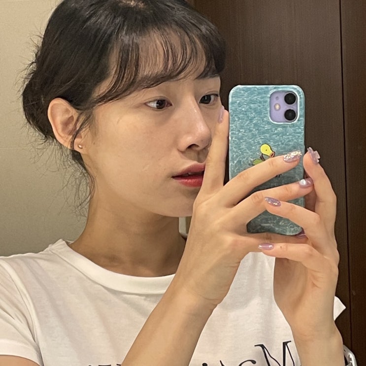 홍대피부과에서 리프테라로 이마리프팅 피부탄력관리 받고 온 후기