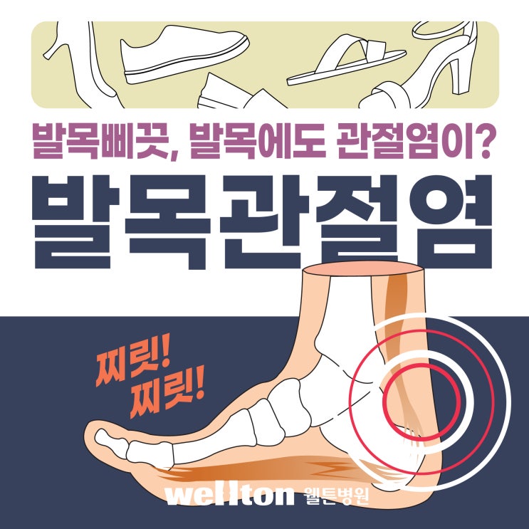  강서구정형외과 발목통증 방치하면? 발목관절염으로 이어질 수 있어
