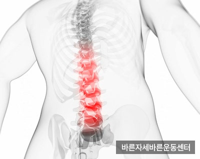 [신반포PT] 사무직을 위한 운동 네 번째! 허리 통증 완화 운동!(part.2 후방 경사)