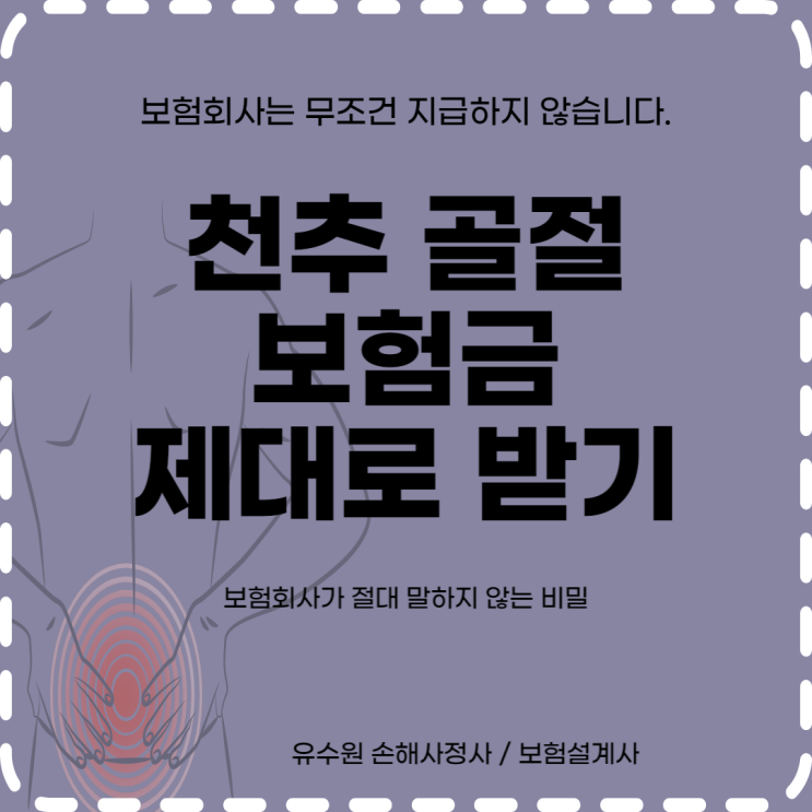  천추골절 보험금 헷갈리지 않도록 이 글 하나로 정리해 드립니다.